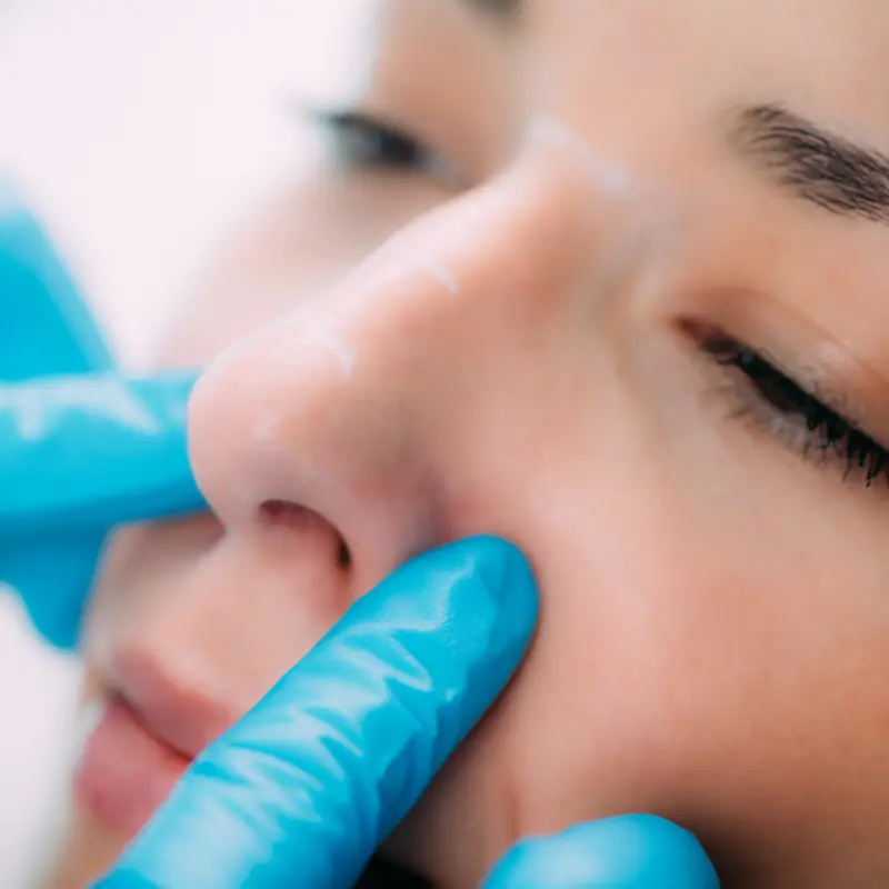 Dermal Fillers at Skin Studio